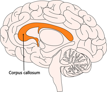 corpus callosum brain diagram